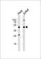 Vasopressin V2 receptor antibody, M01660, Boster Biological Technology, Western Blot image 