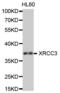 X-Ray Repair Cross Complementing 3 antibody, abx001746, Abbexa, Western Blot image 
