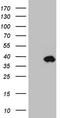 Insulin Like Growth Factor Binding Protein 1 antibody, TA808734, Origene, Western Blot image 