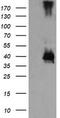 Mitogen-Activated Protein Kinase Kinase 3 antibody, TA505618BM, Origene, Western Blot image 