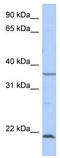 Sprouty RTK Signaling Antagonist 2 antibody, TA339693, Origene, Western Blot image 