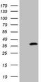 TP53 Regulating Kinase antibody, TA808231S, Origene, Western Blot image 