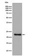 Glutathione Peroxidase 1 antibody, M01019, Boster Biological Technology, Western Blot image 