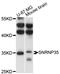 Small Nuclear Ribonucleoprotein U11/U12 Subunit 35 antibody, LS-C748272, Lifespan Biosciences, Western Blot image 
