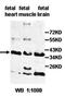 N(4)-(beta-N-acetylglucosaminyl)-L-asparaginase antibody, orb77797, Biorbyt, Western Blot image 