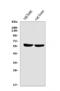 Hepatic triacylglycerol lipase antibody, A01020-1, Boster Biological Technology, Western Blot image 