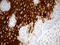 Cornulin antibody, M06991, Boster Biological Technology, Immunohistochemistry paraffin image 