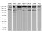 Ubiquitin Like With PHD And Ring Finger Domains 2 antibody, M06294, Boster Biological Technology, Western Blot image 