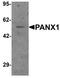 Pannexin 1 antibody, TA319068, Origene, Western Blot image 