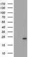 Ubiquitin Conjugating Enzyme E2 E3 antibody, TA504672S, Origene, Western Blot image 