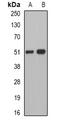 Pancreatic Lipase antibody, LS-B16061, Lifespan Biosciences, Western Blot image 