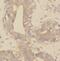 Kinesin Family Member 2A antibody, FNab04560, FineTest, Immunohistochemistry paraffin image 