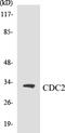 Cyclin Dependent Kinase 1 antibody, EKC1104, Boster Biological Technology, Western Blot image 