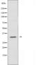 Putative ATP-binding cassette sub-family C member 13 antibody, orb226890, Biorbyt, Western Blot image 
