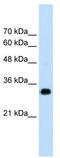 Ring Finger Protein 121 antibody, TA329878, Origene, Western Blot image 