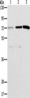 C2 Calcium Dependent Domain Containing 6 antibody, TA349463, Origene, Western Blot image 