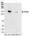 OTU Deubiquitinase 4 antibody, A304-606A, Bethyl Labs, Western Blot image 