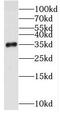 E3 ubiquitin-protein ligase CHIP antibody, FNab08357, FineTest, Western Blot image 