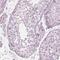 Progestagen Associated Endometrial Protein antibody, NBP1-89781, Novus Biologicals, Immunohistochemistry paraffin image 