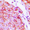 Kinase Insert Domain Receptor antibody, LS-C356165, Lifespan Biosciences, Immunohistochemistry paraffin image 