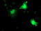 Regulatory Factor X Associated Ankyrin Containing Protein antibody, TA504271, Origene, Immunofluorescence image 
