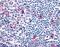 C-C chemokine receptor type 8 antibody, NLS3845, Novus Biologicals, Immunohistochemistry paraffin image 