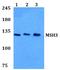 MutS Homolog 3 antibody, A02455, Boster Biological Technology, Western Blot image 