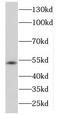DExD-Box Helicase 39A antibody, FNab02306, FineTest, Western Blot image 