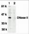 Deoxyribonuclease-2-alpha antibody, 2059, ProSci, Western Blot image 