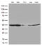 Doublesex And Mab-3 Related Transcription Factor 1 antibody, M02311-1, Boster Biological Technology, Western Blot image 