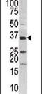 Pantothenate Kinase 3 antibody, PA5-13964, Invitrogen Antibodies, Western Blot image 