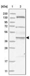 Serologically defined colon cancer antigen 3 antibody, PA5-56109, Invitrogen Antibodies, Western Blot image 