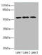 Caspase 2 antibody, A57285-100, Epigentek, Western Blot image 