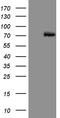 Protein Inhibitor Of Activated STAT 2 antibody, TA808334, Origene, Western Blot image 