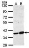 Aminocarboxymuconate Semialdehyde Decarboxylase antibody, orb69803, Biorbyt, Western Blot image 