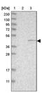 DNA Polymerase Gamma 2, Accessory Subunit antibody, PA5-54721, Invitrogen Antibodies, Western Blot image 
