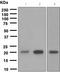 Suppressor of cytokine signaling 2 antibody, TA307336, Origene, Western Blot image 