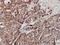 Glucosylceramidase Beta antibody, ab55080, Abcam, Immunohistochemistry paraffin image 