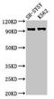 Potassium Voltage-Gated Channel Subfamily Q Member 3 antibody, LS-C671650, Lifespan Biosciences, Western Blot image 