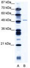 Zinc Finger Protein 627 antibody, TA337900, Origene, Western Blot image 