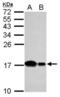 Ubiquitin-conjugating enzyme E2 D2 antibody, NBP2-20783, Novus Biologicals, Western Blot image 