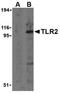 Toll Like Receptor 2 antibody, ADI-905-710-100, Enzo Life Sciences, Western Blot image 