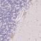 Pancreatic Lipase Related Protein 3 antibody, NBP2-49031, Novus Biologicals, Immunohistochemistry paraffin image 