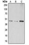 Abhydrolase Domain Containing 8 antibody, MBS821910, MyBioSource, Western Blot image 