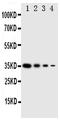 Eukaryotic translation initiation factor 2-alpha kinase 4 antibody, GTX12292, GeneTex, Western Blot image 