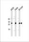 Homeobox protein CDX-1 antibody, TA324585, Origene, Western Blot image 