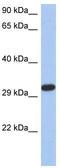 Capping Actin Protein Of Muscle Z-Line Subunit Alpha 3 antibody, TA344270, Origene, Western Blot image 