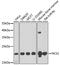 Neuronal Calcium Sensor 1 antibody, 22-237, ProSci, Western Blot image 
