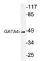 GATA Binding Protein 4 antibody, AP20302PU-N, Origene, Western Blot image 