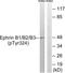 EPHB1 antibody, LS-C198926, Lifespan Biosciences, Western Blot image 